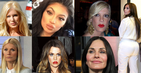11 plastic surgery celebs ok wide