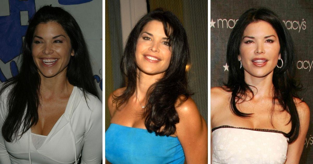 lauren sanchez plastic surgery before after photos
