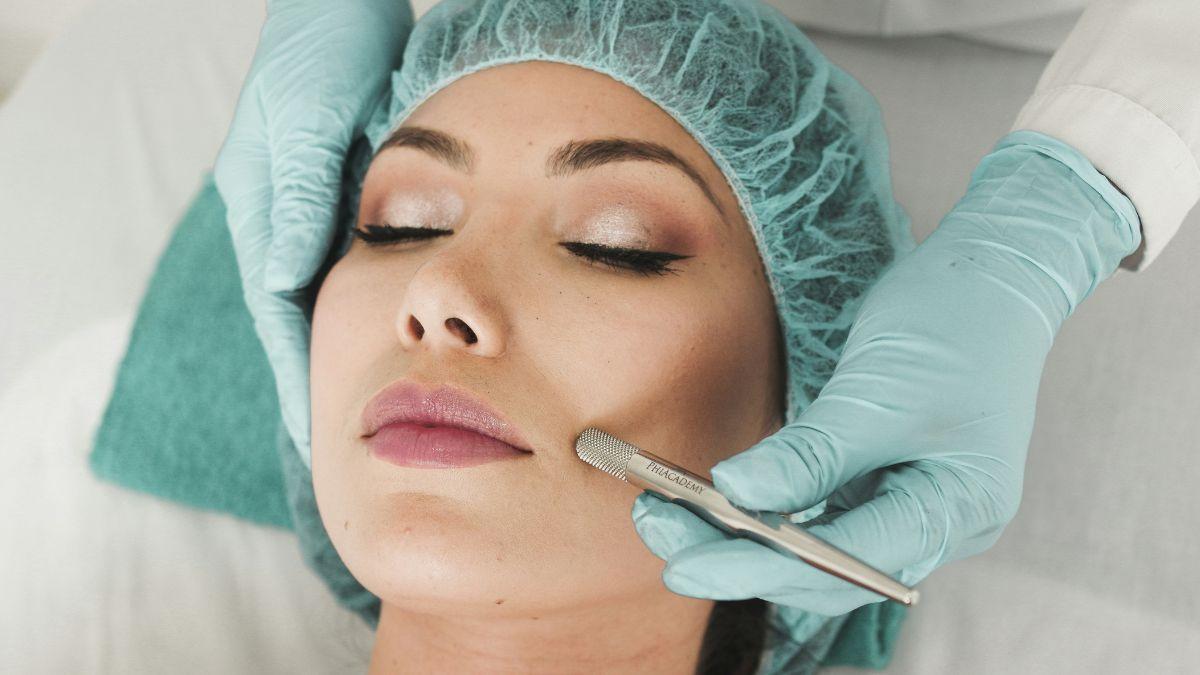 image of The expert says there are many benefits to getting a chemical peel.