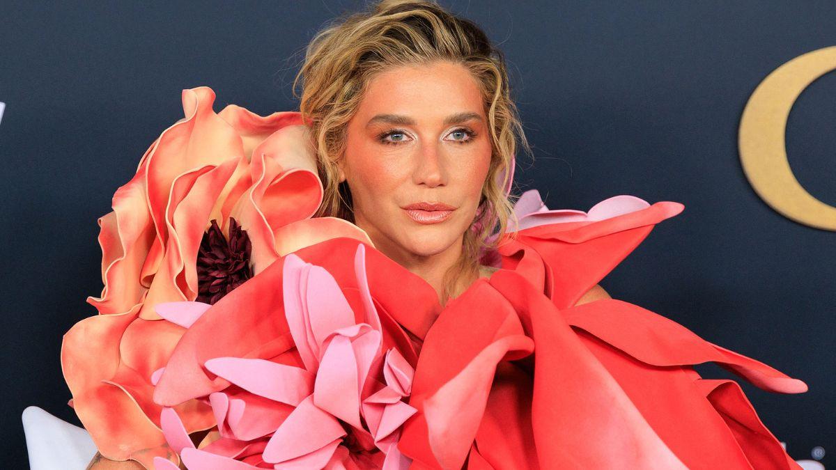 Photo of Kesha