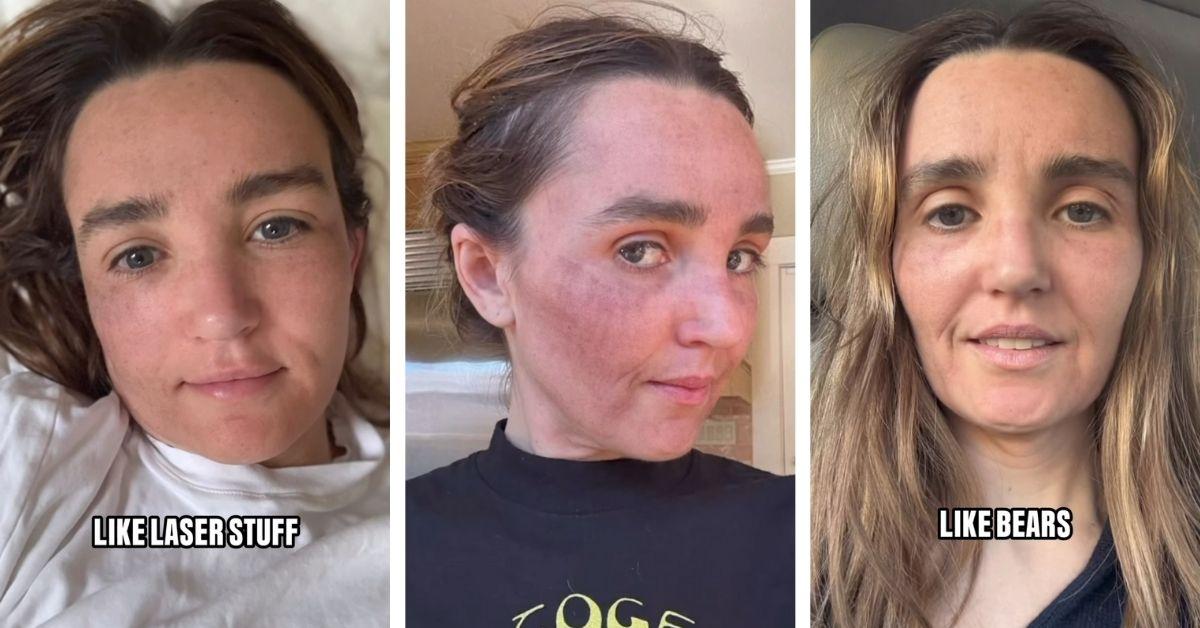 image of The 'Saturday Night Live' star joked about women secretly disappearing for cosmetic procedures.