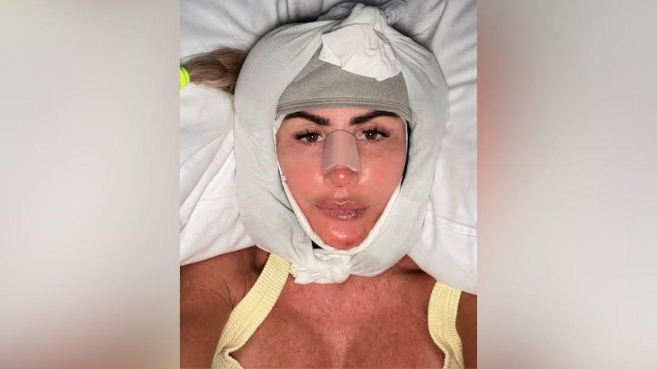 rachel uchitel dramatic facelift transformation before after photos