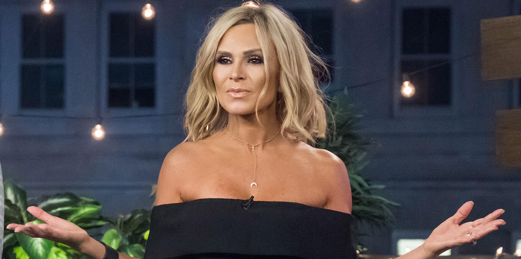 Tamra judge facelift photos 1