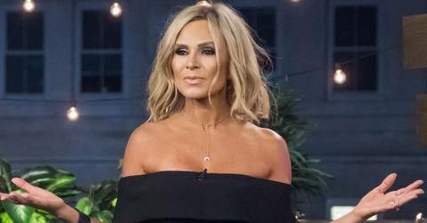 Tamra judge facelift photos 1