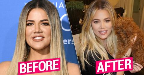 Khloe Kardashian Nose Job