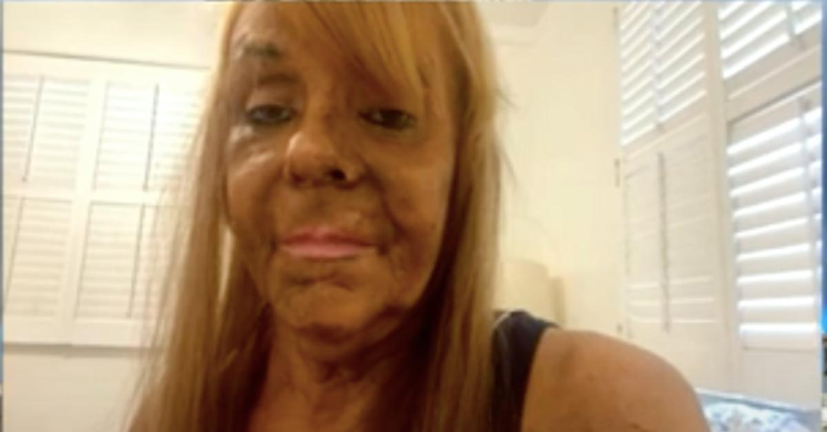 Tan Mom Patricia Krentcil Claims She Cut Down On Tanning 