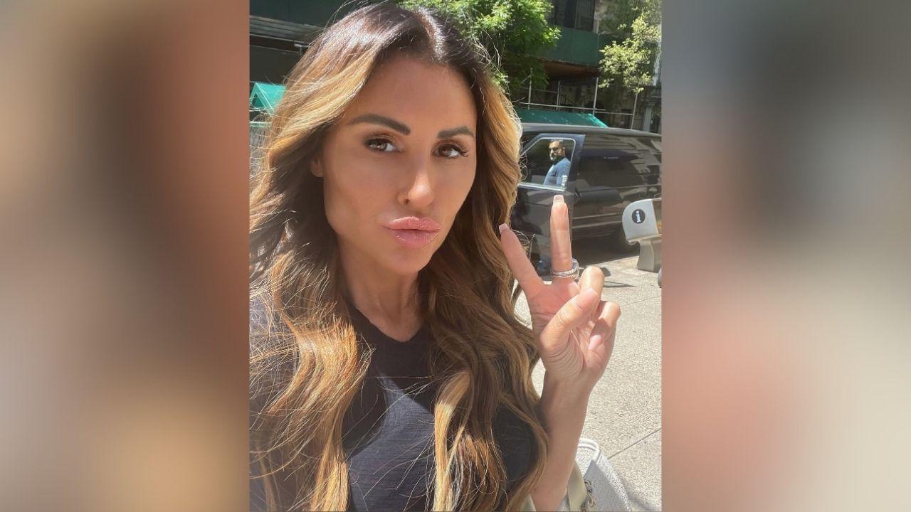 rachel uchitel dramatic facelift transformation before after photos