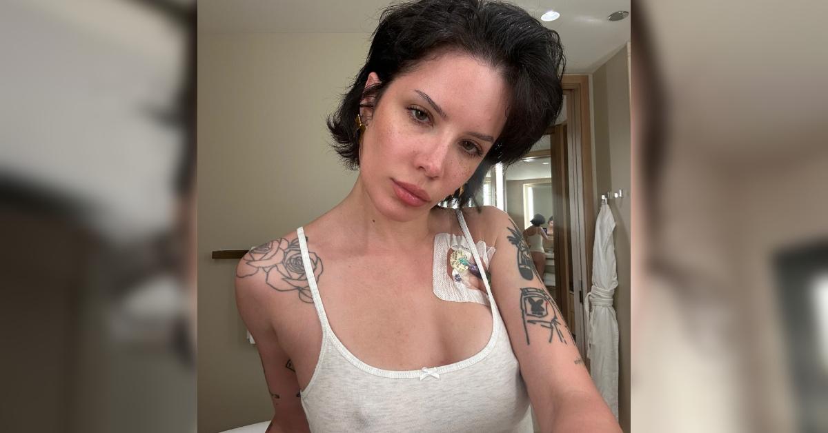 halsey medical port chest exposes body photo
