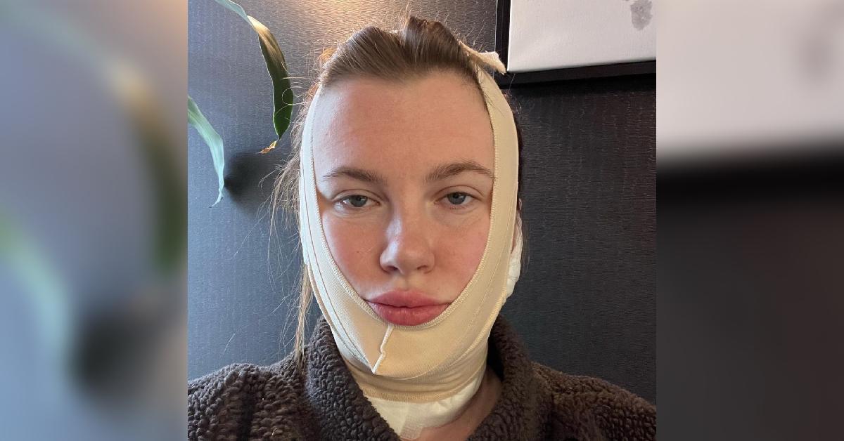 ireland baldwin update recovery status