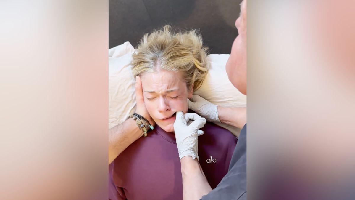 Image of LeAnn Rimes cried as she had her jaw tension released.
