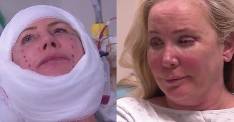 Vicki gunvalson shannon beador rhoc plastic surgery photos