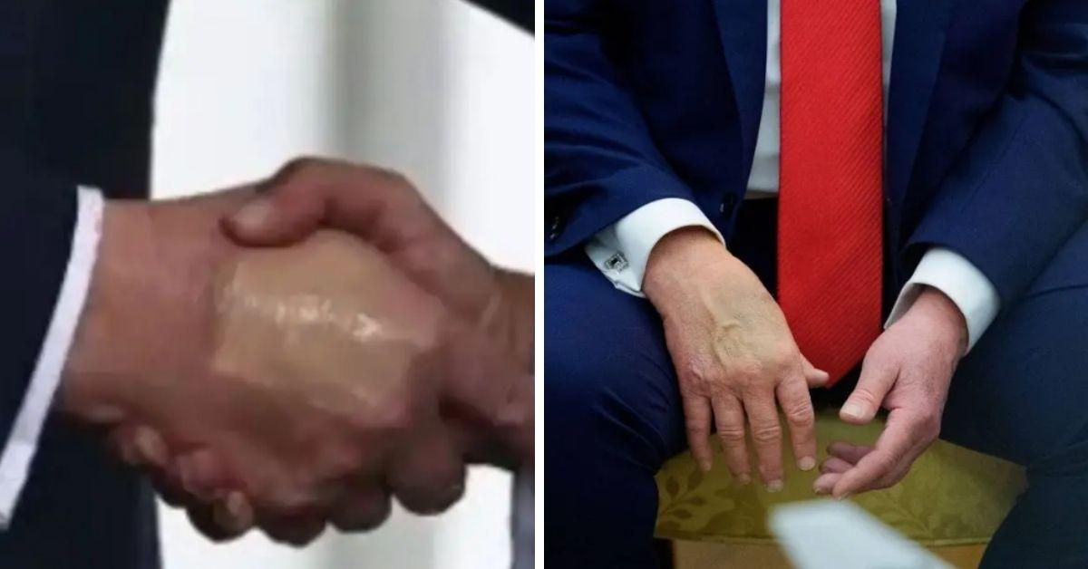 image of The POTUS admitted to using makeup on his hands.