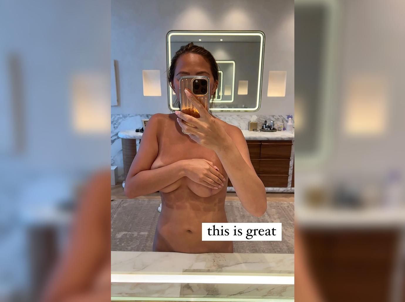 chrissy teigen toplessig