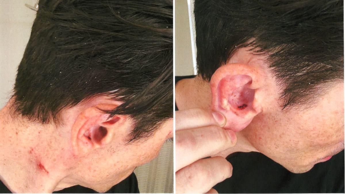 Image of Tom Sandoval filed photos of his alleged injuries in Los Angeles Superior Court.