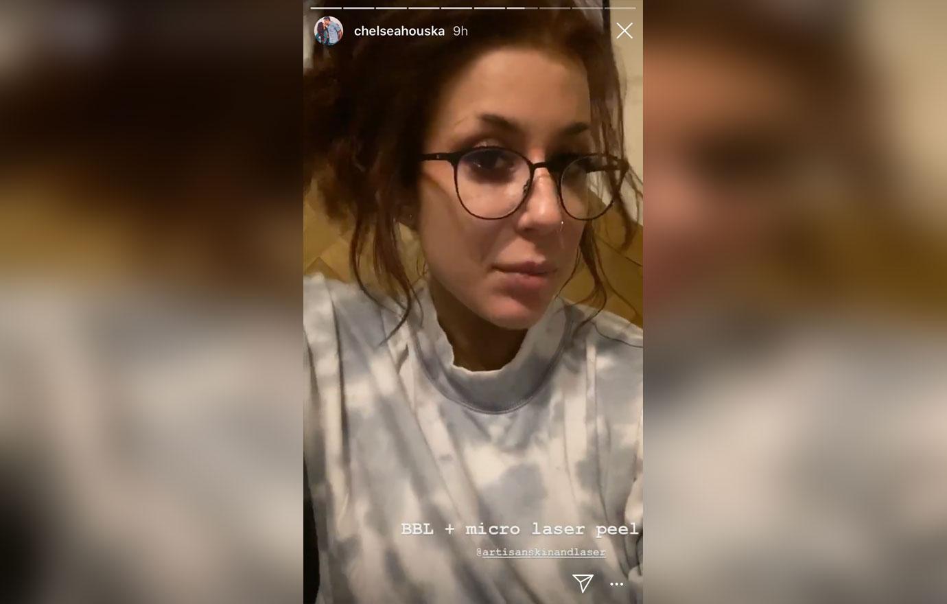 chelsea-houska-instagram-facial-peel-results-video