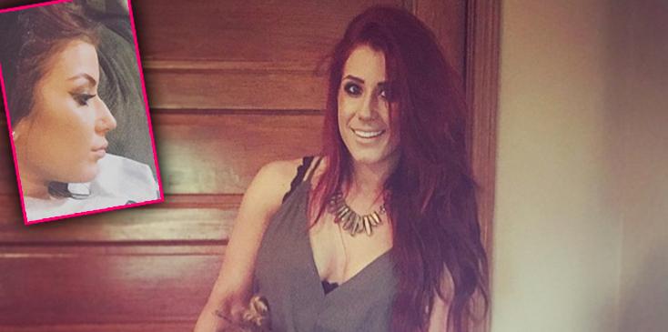 chelsea houska nose job plastic surgery teen mom 2