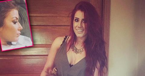 chelsea houska nose job plastic surgery teen mom 2