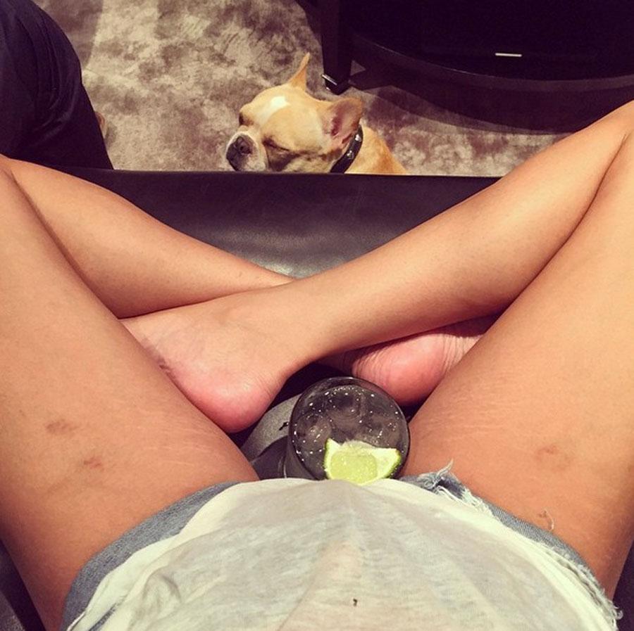 Chrissy teigen stretch marks instagram 01