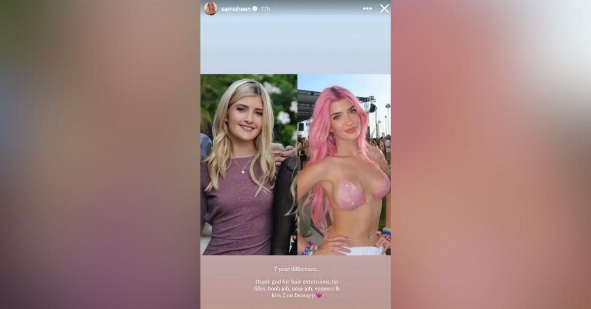 image of Sami Sheen revealed all the plastic surgeries she’s had over the years.
