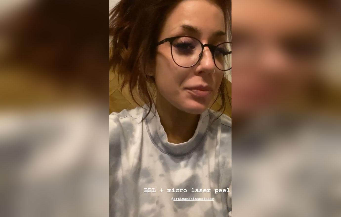 chelsea-houska-instagram-facial-peel-results-video