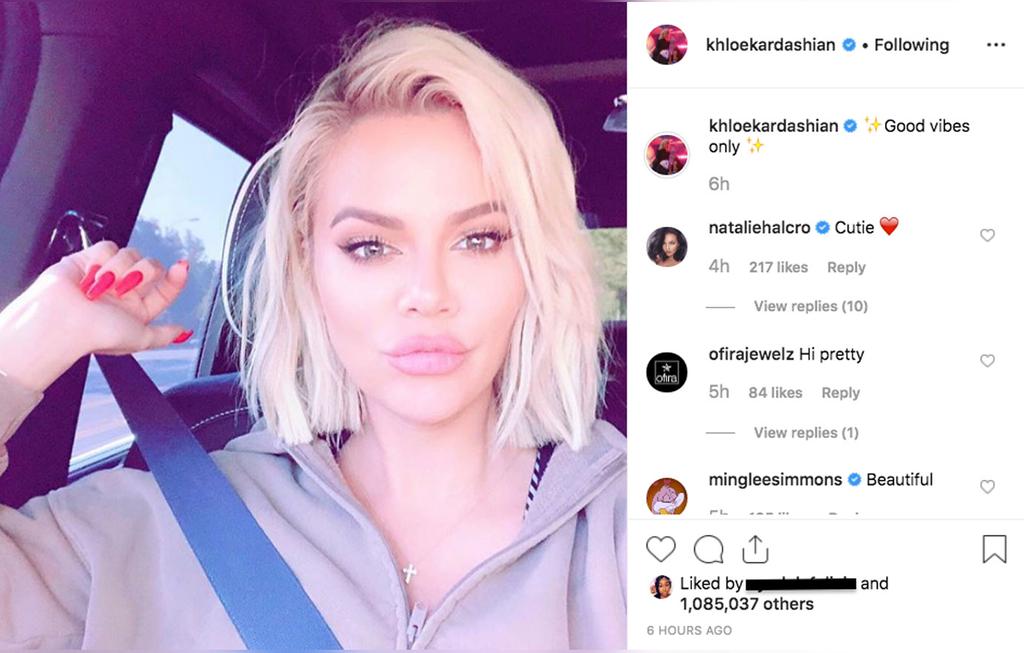 Fans Slam Khloe Kardashian’s Lips In A New Selfie