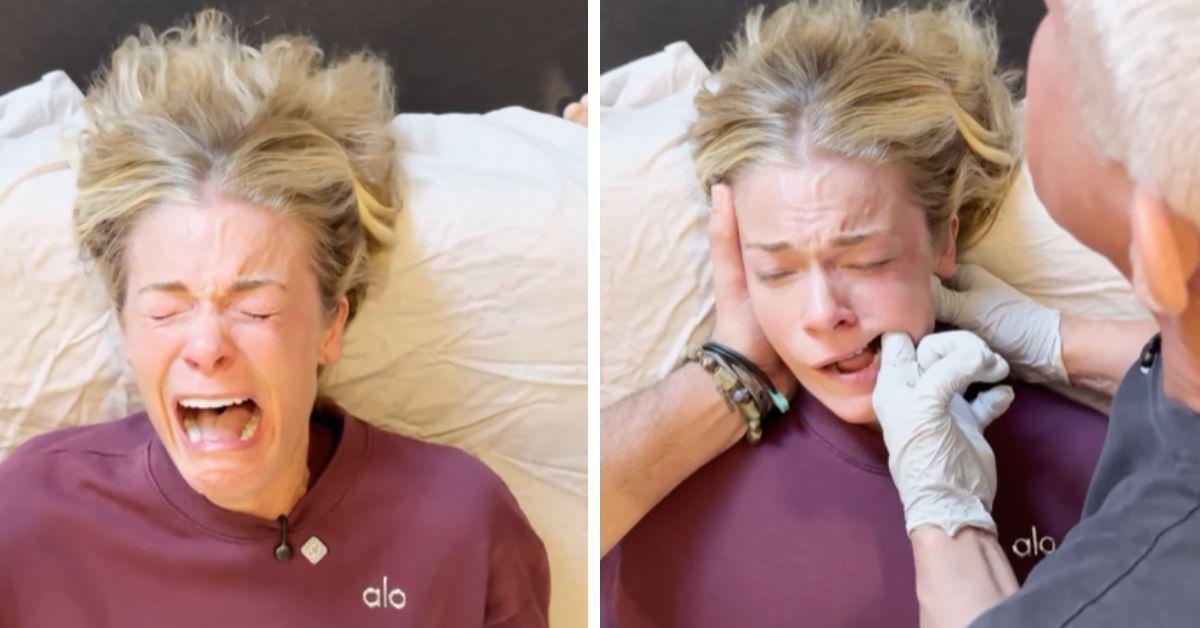 image of The singer explained that her health issues began after taking antibiotics and revealed that she has been drinking coconut water, aloe vera juice, and rosemary to help heal naturally.