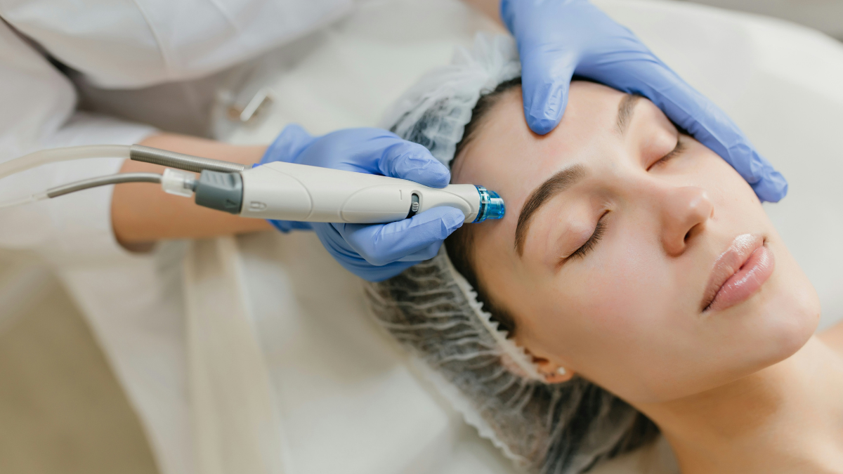 rf micro needling is asserted as the future of non surgical skin tightening procedures
