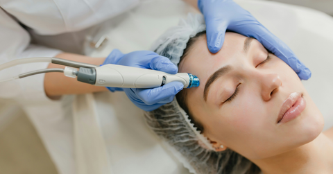rf micro needling is asserted as the future of non surgical skin tightening procedures