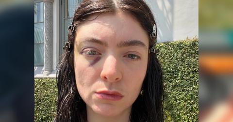 Lorde Drives Shirtless In Rare Bikini Photo As Fans Beg For New Music