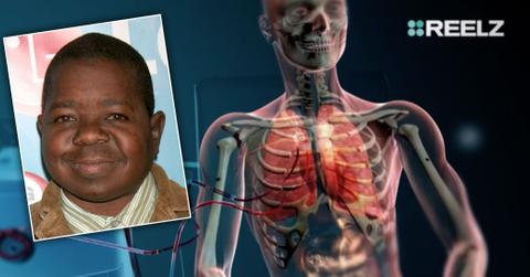 autopsy gary coleman tragic death