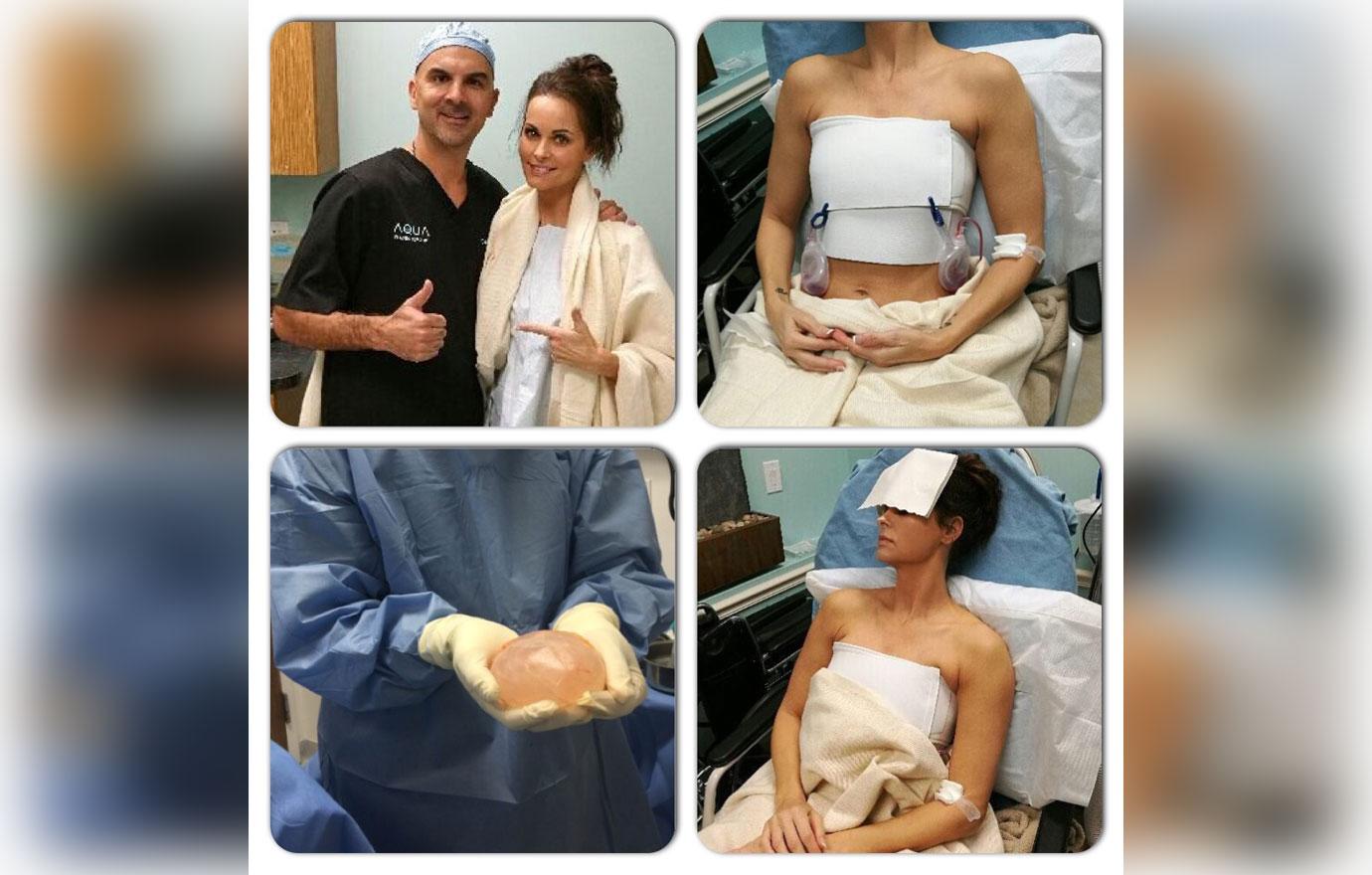 Karen McDougal Breast Implant Surgery 05