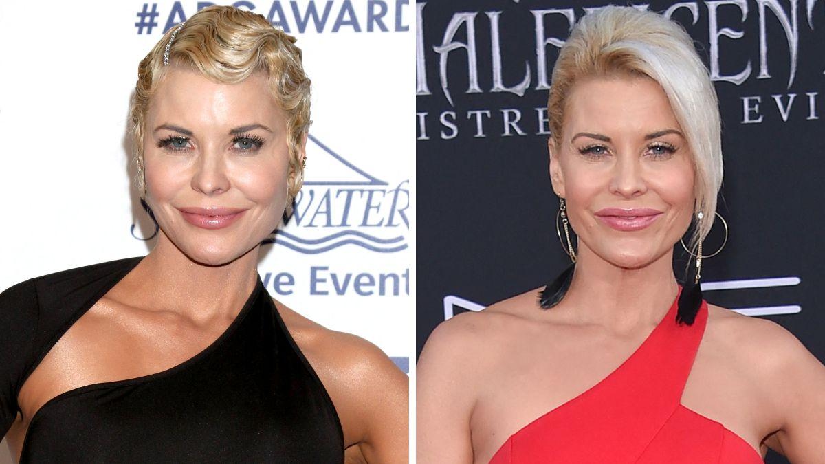 celebrities who got facelifts before after photos