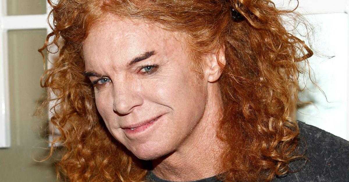 Carrot Top Is 'Doing Well' After Being Released From&hellip;