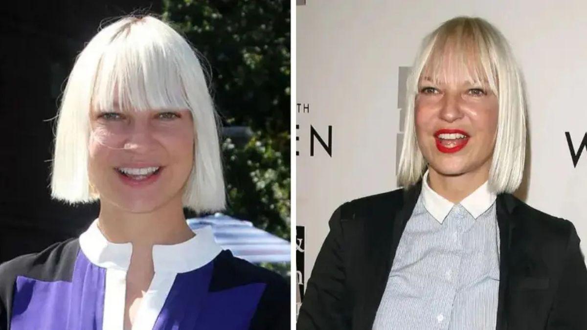 celebrities who got facelifts before after photos