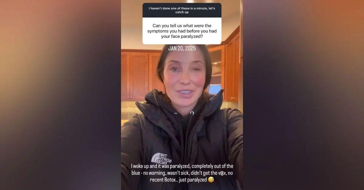 Photo of Bristol Palin's condition was believed to be Bell's Palsy.