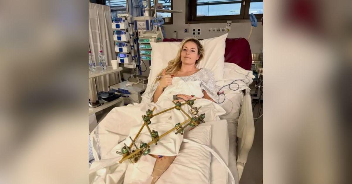 image of Despite the setback, she made it clear she doesn’t want to be defined by the accident.