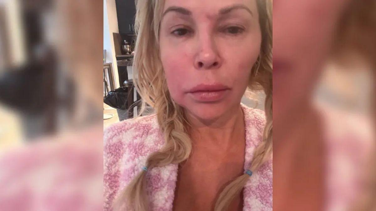 Photo of The mom-of-two spent six figures treating her facial parasite.