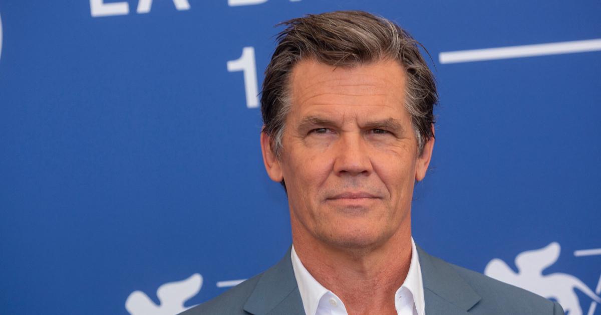 josh brolin stress mild case bells palsy facial paralysis childhood trauma