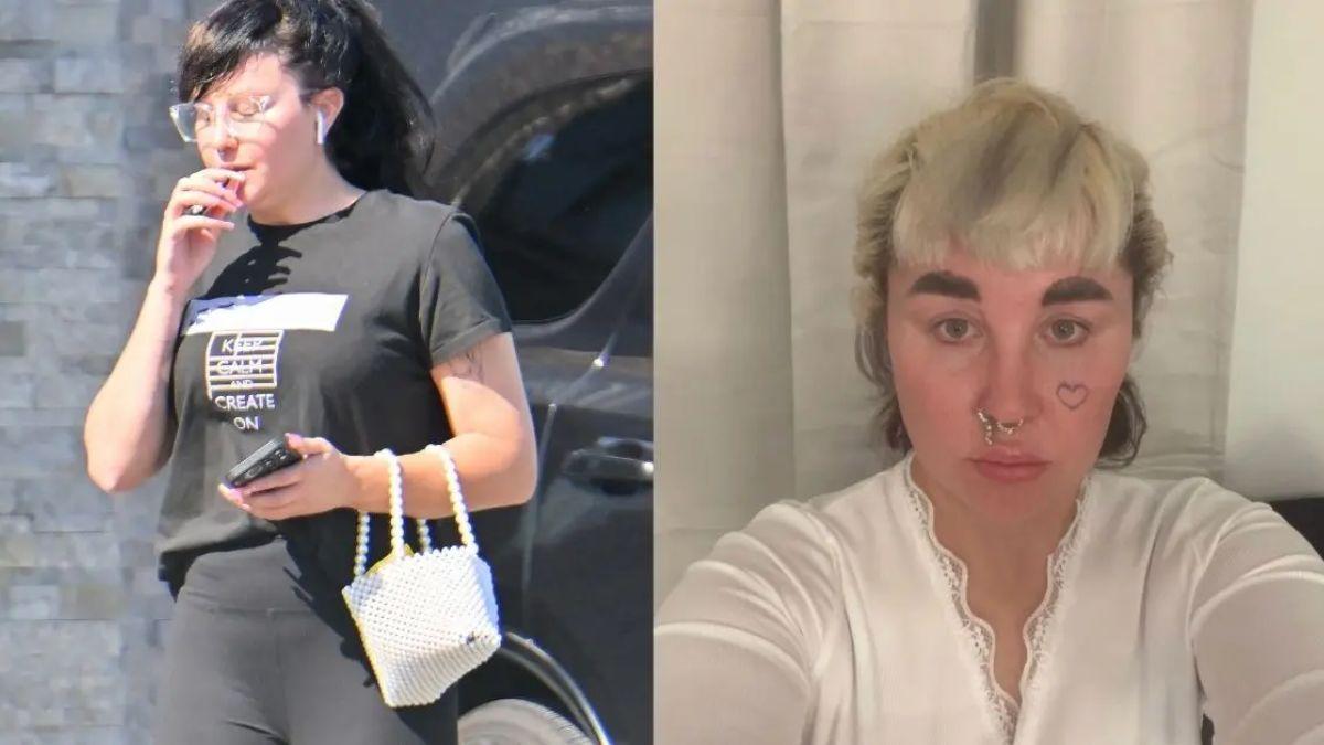 image of Amanda Bynes revealed she's been taking Ozempic to lose weight. 