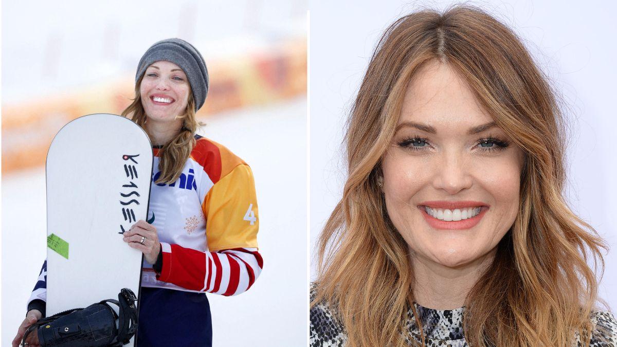 photo of Amy Purdy. 