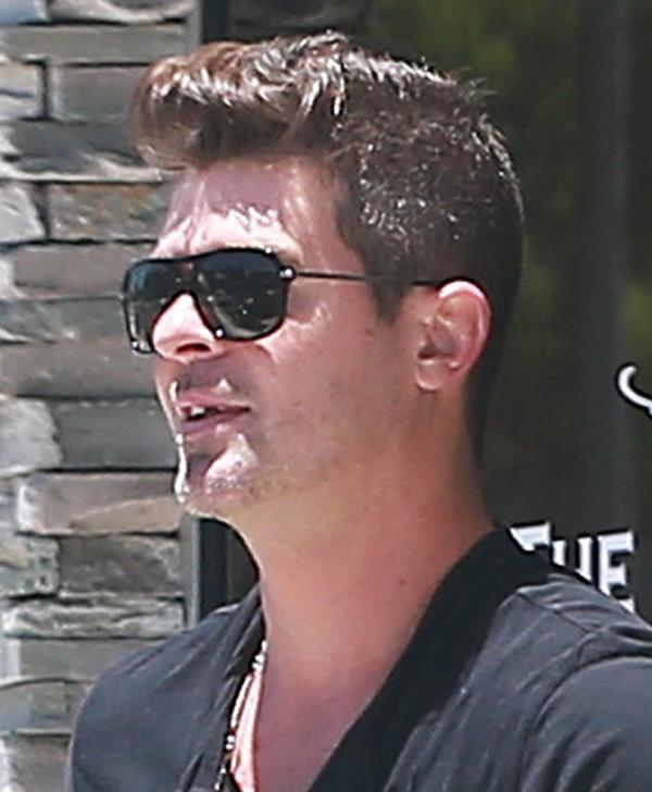 Exclusive&#8230; Robin Thicke Reveals Missing Teeth At The Dentist! NO INTERNET USE WITHOUT PRIOR AGREEMENT