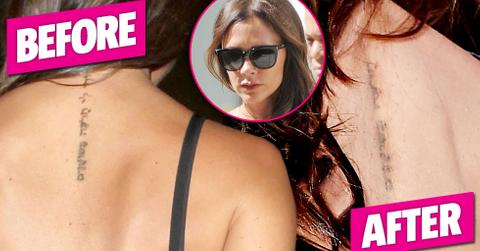 Victoria bechkam back tattoo removal nyfw