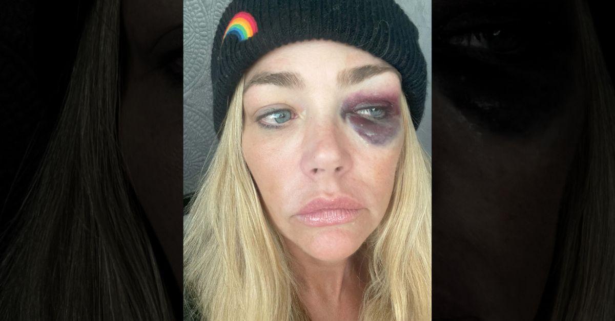 Photo of Denise Richards
