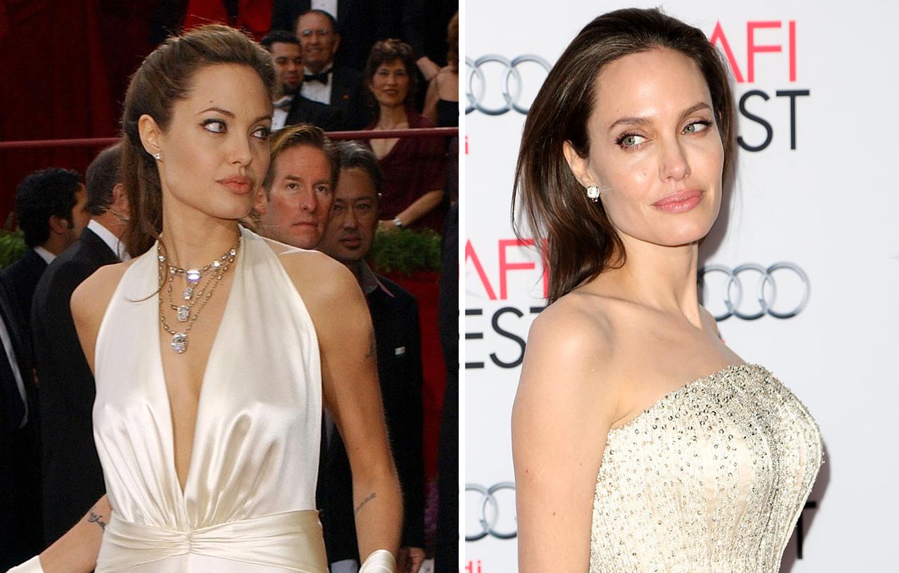 Stars Who Have Gotten Breast Implants Before And After Plastic Surgery Photos 