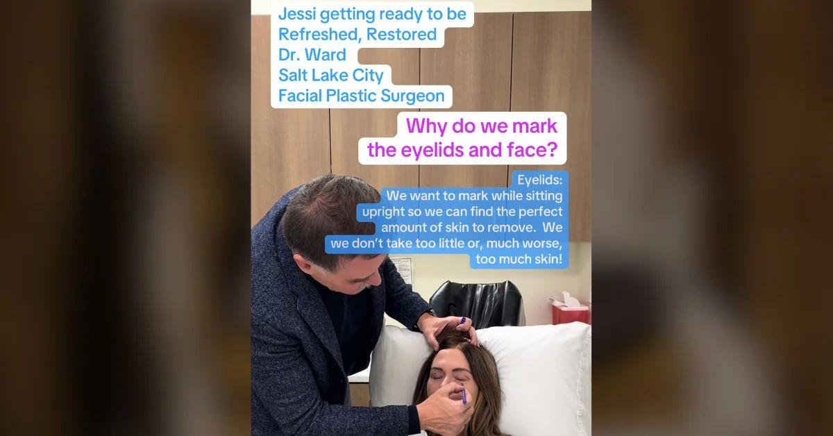 Photo of Fans initially believed Jessi Ngatikaura was undergoing a facelift due to the amount of markings on her face.