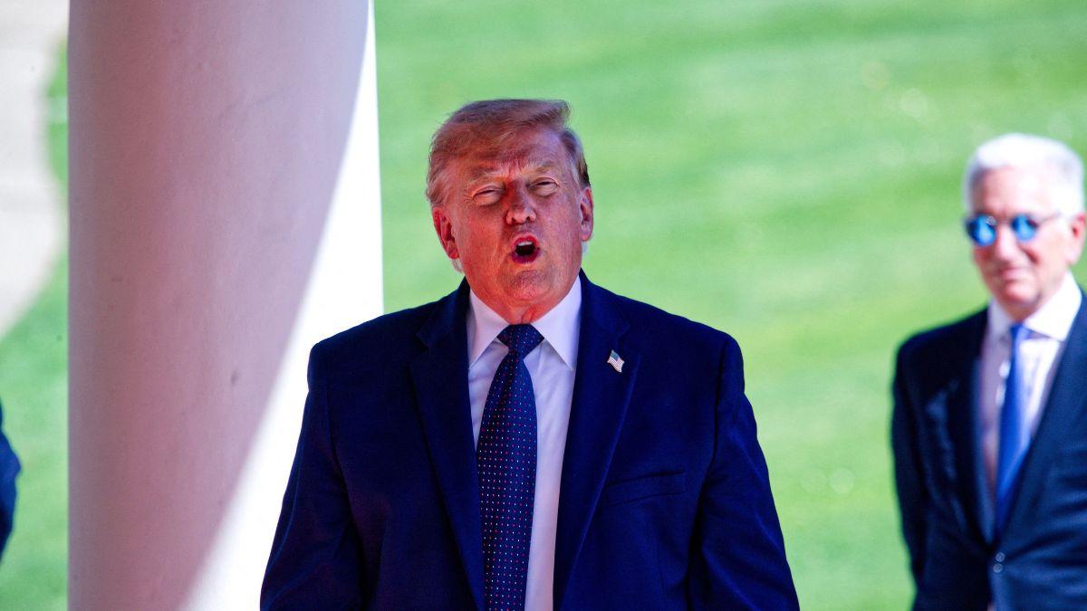 Photo of Donald Trump suffers from chronic venous insufficiency.