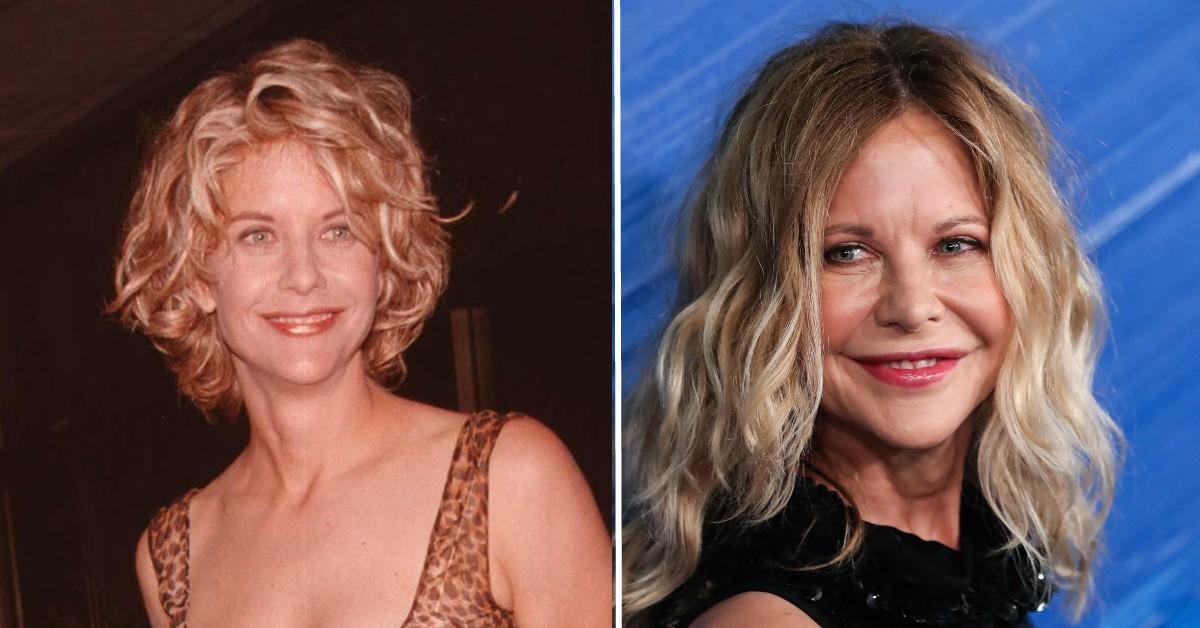 Has Meg Ryan Had Plastic Surgery? Doctors Tell All