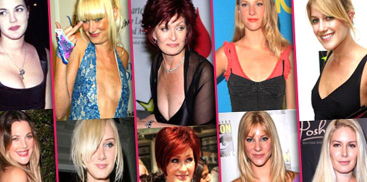 Photos from Celebs Who've Had Breast Reductions