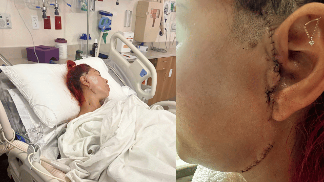 Image of Farrah Abraham revealed stitches around her ear and underneath her jaw while documenting the intense recovery process.