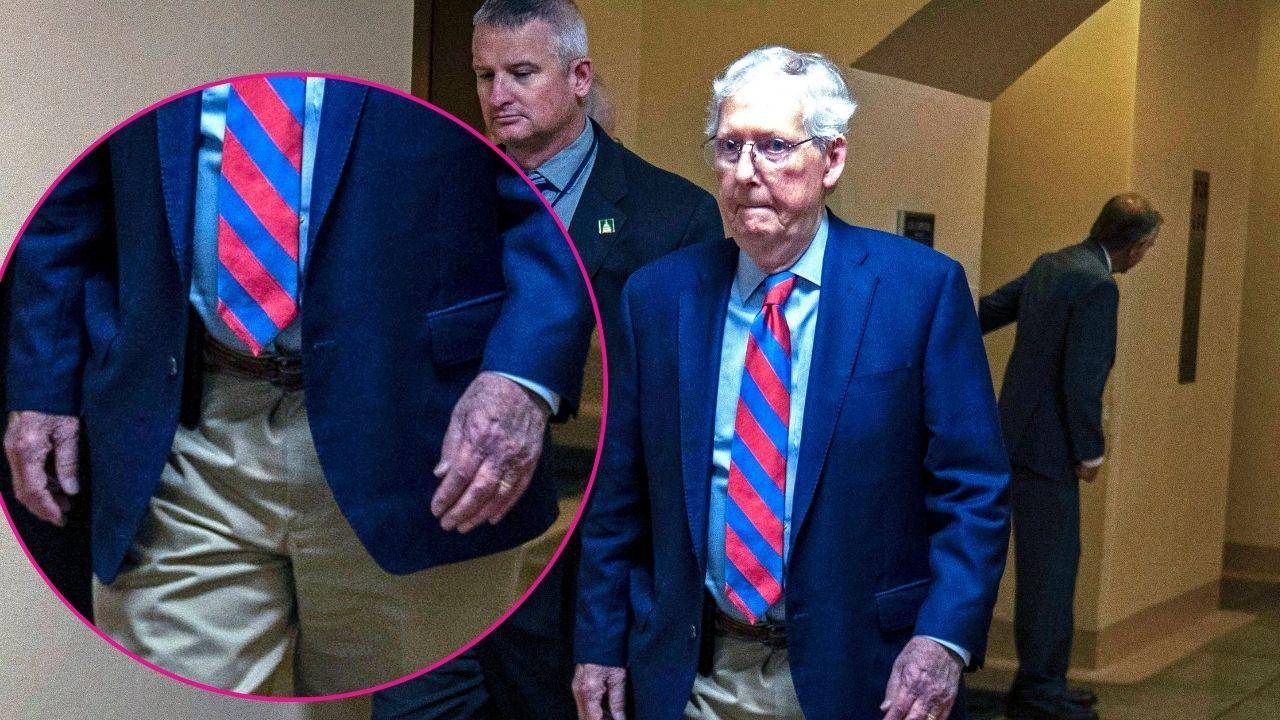 Image of Mitch McConnell returned to Capitol Hill with visible bruising on both hands.
